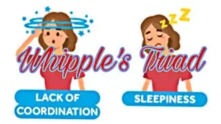 Whipple's Triad|Hypoglycemia Symptoms|Knowledge Madnoob