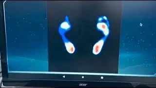 Foot pressure detection system by forelaX