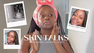 LET'S TALK SKINCARE | FilterBaby 3 Month UPDATE: Does it really clear your skin?