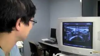Bipolar disorder and heart disease: study examines the connection