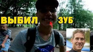 Выбил зуБ!