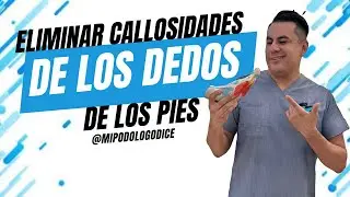 CÓMO ELIMINAR CALLOSIDADES DE LOS DEDOS DE LOS PIES? 🤔
