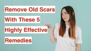 Remove Old Scars With These 5 Highly Effective Remedies