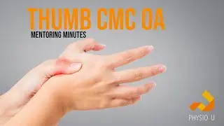 Thumb CMC OA: Osteoarthritis of Carpometacarpal Thumb Joint | Assessment and Treatment