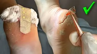 🎁Пищевой КРАСИТЕЛЬ на ПЕДИКЮРЕ. 👣ПЕДИКЮР Пошагово. СУХИЕ ПЯТКИ. ТРЕЩИНЫ. DIY Pedicure at Home