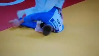 Leva noga desni brc