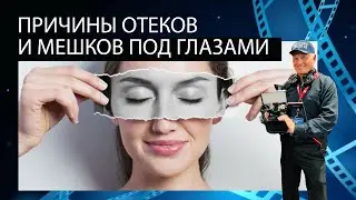 ПРИЧИНЫ ОТЕКОВ И МЕШКОВ ПОД ГЛАЗАМИ