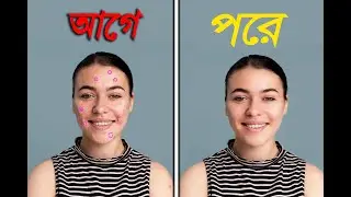 ফটোশপ দিয়ে মুখের দাগ মুছে ছবি সুন্দর করুন এবং ইসমুত করুন