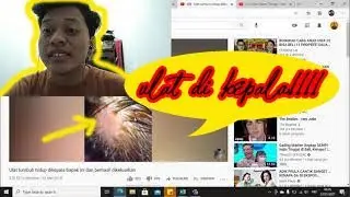 Mengeluarkan ulat di kepala [Reaction] Satisfying video
