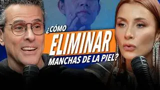 Cómo quitar manchas sin dañar tu piel - Dra.  Karen Carrillo y Marco Antonio Regil