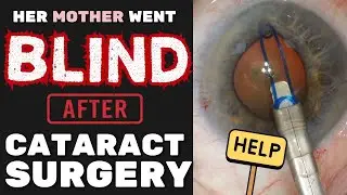 Cataract Surgery - When Fear meets Opportunity | Malyugin Ring, IFIS, Karate Chop