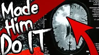 The case of Mr. Oft Proves You have NO Free Will