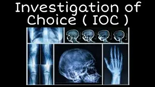 Investigation of Choice of Various Diseases || Mis.Medicine