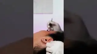 Did you watch this earing fitting video