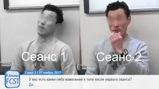 Пример лечения Дистония