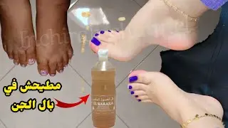 اقسم بالله اقوى وصفة لتبييض تخلي وجهك وجسمك كيف لمرايا ❤