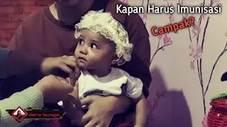 KAPAN IMUNISASI CAMPAK DIBERIKAN?