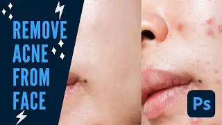 Spot Healing Brush Tool in Photoshop CC - Remove Spot and Acne From Face