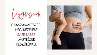 Császármetszési heg kezelése Safe Laser lágylézer készülékkel