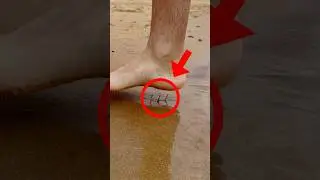 Don't run into the water at the beach (spiderfish) 
