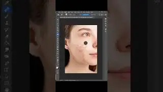 Remove pimples in Photoshop 