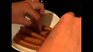 Embarrassing Bodies split penis