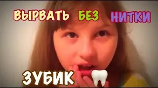 Зубик молочный Как вырвать без нитки и быстро #зубик