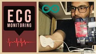 ECG Monitoring system with AD8232 Sensor || Arduino and AD8232 sensor based ECG Monitoring system