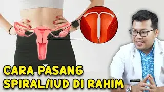 CARA MEMASANG KB IUD ATAU KB SPIRAL DI RAHIM DAN MANFAATNYA - DOKTER SADDAM ISMAIL