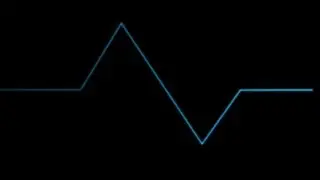 ECG Free Adobe After Effects Template