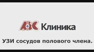 УЗИ сосудов полового члена.
