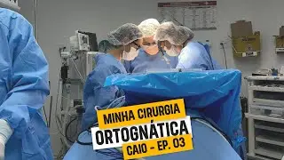 Cirurgia Ortognática - Microssomia Hemifacial - EP. 03