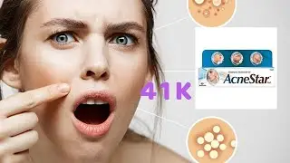 Acne Star Gel work or not /honest review /supriya the classy tips