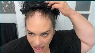 How I covered this thinning hair