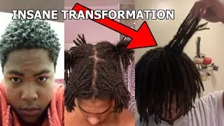 CRAZY 2 Year Semi Freeform Dreadlock Transformation 😲🔥