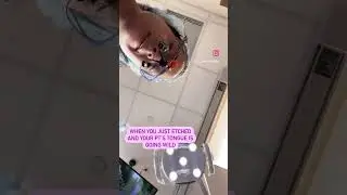 Don’t make me whip out the rubber dam 😂