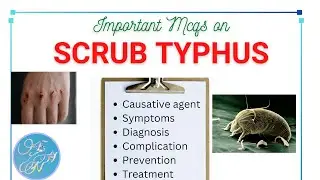 Scrub typhus MCQs questions with answers।। Detailed epidemiology (symptoms, Complication, Treatment)
