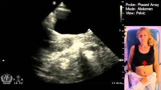 FAST Scan (Female Considerations)