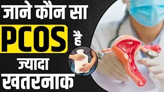 PCOS के 4 प्रकार- लक्षणों से जानिए आप हैं किससे बीमार | Which type of PCOS is dangerous |