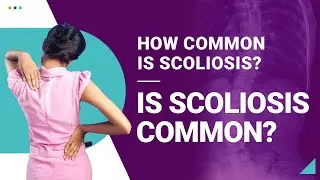 How Common is Scoliosis? Is Scoliosis Common?