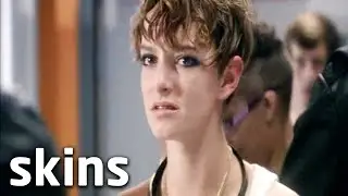 Franky's Photos Get Leaked | Skins
