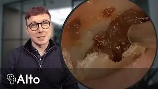 Ear Wax Removal CURES Tinnitus