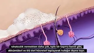 Kulak Kiri Nasıl Oluşur?
