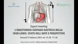 Expert Meeting - L’anastomosi esofago-gastrica nella Ivor-Lewis: stato dell’arte e prospettive