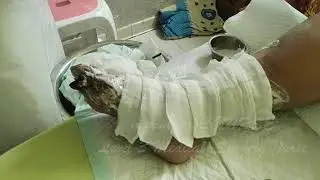 LUKA DIABETES NANAHNYA BANYAK BANGET DI DALAM KAKI