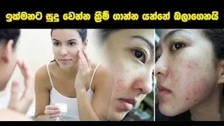 Dangers of Skin Whitening Products - Sinhala Article