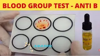 Blood Grouping Anti B 1x10 ml Procedure | Blood Group Test Anti B