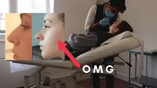 Getting A Non Surgical Nose Job In 5 Minutes VLOG *I got Chin Filler too*
