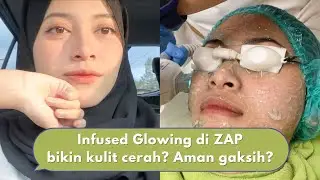 Treatment Mencerahkan Kulit di ZAP! Infused Glowing Premium + Alma Beauty Rejuve Cuma Rp 299.000 !🤩