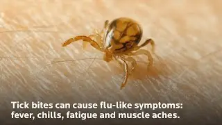Tips to Navigate Tick Bites